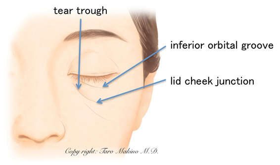 下まぶたイラスト