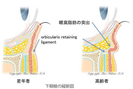 くま断面イラスト