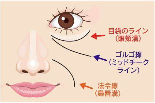 中顔面の老化イラスト