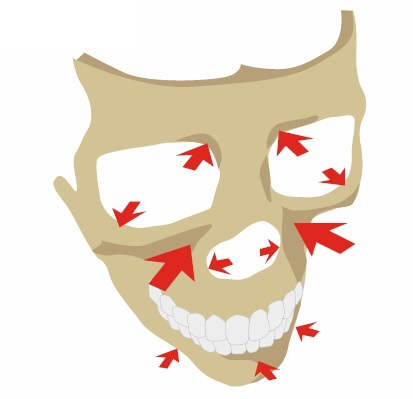 老化による骨の萎縮イラスト