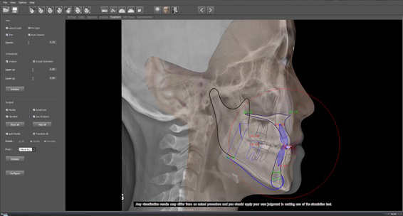 シュミレーションデモ画像3